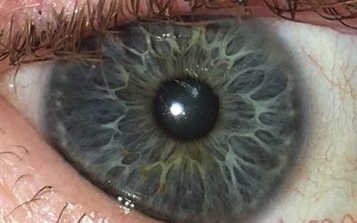 The Intuitive Eye