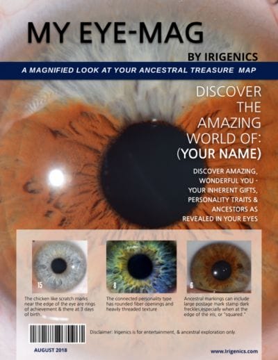 My-Eye-Mag (Your Custom 38-page,Digital "Eye Magnified" Report!)